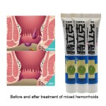 Hemorrhoids Ointment Supplier - 20g Internal External Mixed Anal Care