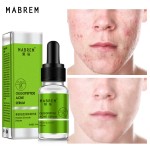 Acne Cleanser Serum Manufacturer - Oligopeptide Pore Repair Anti-Aging