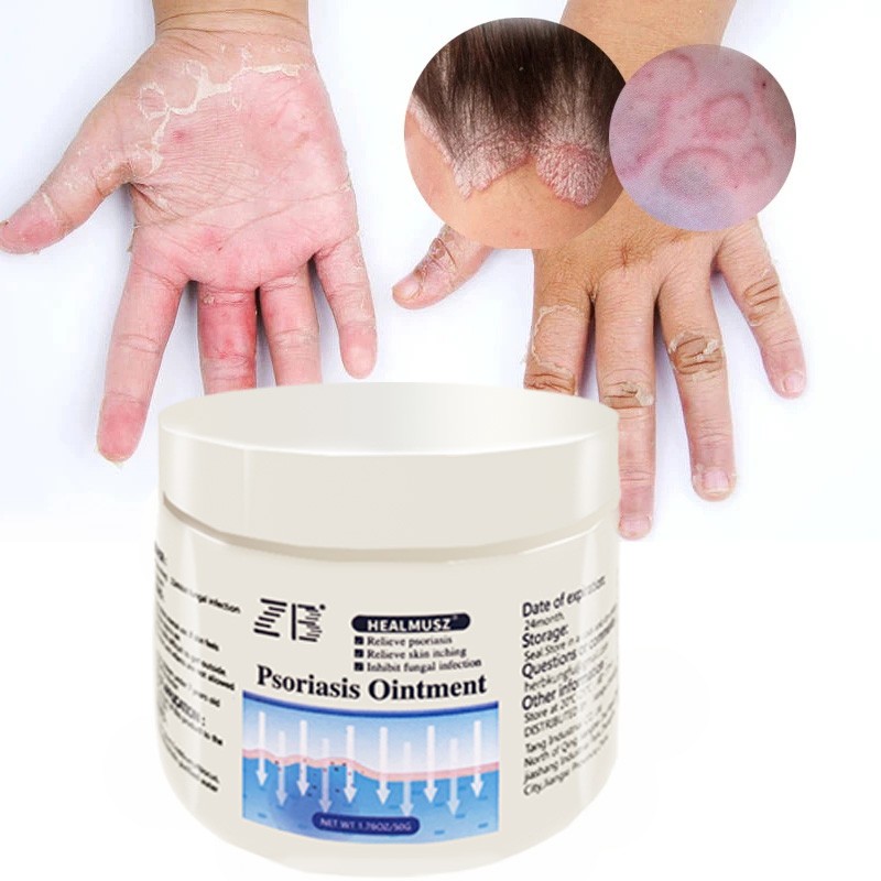 Herbal Ointment Supplier - 50g Chinese Medicine Anti-Itching Cream