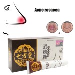 Nose Mides Cream Manufacturer - Herbal Rosacea Blackhead Remover Ointment