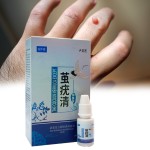 Wart Remover Manufacturer - Plantar Warts Corpus Callosum Fast Removal