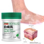 Vitiligo Cream Factory - 30g Antibacterial Psoriasis White Spots Ointment