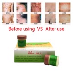 Herbal Ointment Factory - Natural Dermatitis Psoriasis Pruritus Cream