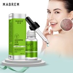 Acne Cleanser Serum Manufacturer - Oligopeptide Pore Repair Anti-Aging