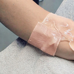 Scar Sheets Factory - OEM Medical Grade Silicone Gel