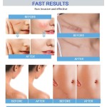 Scar Sheets Supplier - OEM Wholesale Waterproof Skin Color