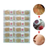 Corn Removal Plaster Manufacturer - OEM Foot Protection Pain