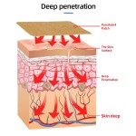 Muscle Pain Patch Factory - OEM Component Rehabilitation Therapy