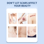 Scar Removal Gel Manufacturer - OEM Vegan Skin Repairing