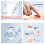 Scar Relief Cream Supplier - OEM Natural Herbal Professional