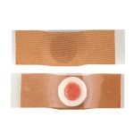 Medical Corn Patch Factory - OEM Pain Free Skin Soften