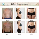 Belly Slimming Patch Factory - OEM Mugwort Abdominal Flat