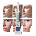 Silicone Scar Gel Factory - OEM Customized Labels Hydrate