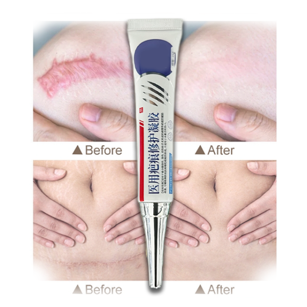 Scar Relief Cream Supplier - OEM Natural Herbal Professional