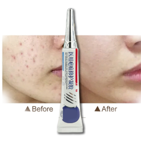 Scar Gel Manufacturer - OEM Custom Package Skin Care