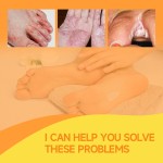 Herbal Ointment Manufacturer - OEM/ODM Natural Plant Cream for Psoriasis