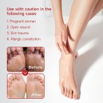 Eczema Ointment Manufacturer - Herbal Psoriasis Skin Care Relief Plaster