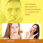 Oral Care Spray Manufacturer - ZouRunAn Gum Pain Canker Sores 30ml Liquid