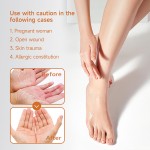 Foot Spray Manufacturer - Herbal Rough Beriberi Repair Spray 60ml Wholesale