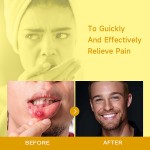 Joint Pain Spray Supplier - 60ml Lumbar Cervical Knee Discomfort Relief