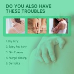 Skin Care Ointment Manufacturer - 20g Herbal Itchy Sensitive Skin Cream