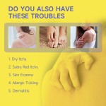 Sulfur Ointment Supplier - Herbal Eczema Psoriasis Peeling Skin Care