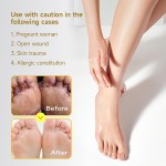 Herbal Ointment Manufacturer - OEM/ODM Natural Plant Cream for Psoriasis