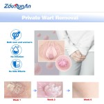 Toothache Spray Manufacturer - 20ml Herbal Gum Pain Canker Sore Treatment