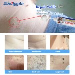 Toothache Spray Manufacturer - 20ml Herbal Gum Pain Canker Sore Treatment