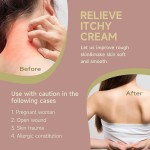 Skin Itchy Cream Factory - 20g Psoriasis Cleansing Chinese Plaster Ointment