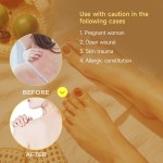 Beriberi Cream Manufacturer - ZouRunAn New Itchy Foot Discomfort Relief Cream