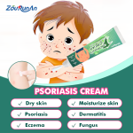 Psoriasis Ointment Supplier - ZouRunAn Quick Effective Skin Discomfort Cream