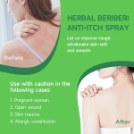 Foot Ointment Factory - Herbal Itchy Peeling Feet Skin Discomfort Care