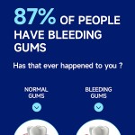 Propolis Oral Spray Supplier - 30ml Canker Sores Pharyngitis Fresh Breath