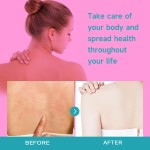 Back Acne Spray Factory - 30ml Soothing Itchy Skin Relief New Arrival