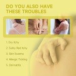 Anti Itch Ointment Manufacturer - Herbal Extract Eczema Sensitive Skin Care