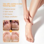 Foot Skin Ointment Supplier - Plant Formula Itchy Peeling Feet Comfort Care