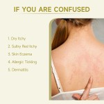 Itchy Skin Ointment Supplier - Fast Relief Moisturizing Chinese Plaster Care