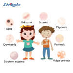 Psoriasis Ointment Supplier - ZouRunAn Quick Effective Skin Discomfort Cream