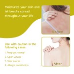 Anti Itch Ointment Manufacturer - Herbal Extract Eczema Sensitive Skin Care