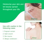 Skin Care Ointment Manufacturer - 20g Herbal Itchy Sensitive Skin Cream