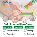 Anti-itch Cream Manufacturer - ZouRunAn New Arrived Psoriasis Relief Ointment