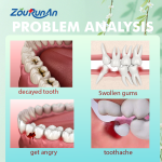 Oral Care Spray Supplier - 30ml Toothache Gum Discomfort Relief Spray