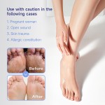 Herbal Foot Spray Factory - 60ml Smelly Sweaty Itchy Feet Care Spray