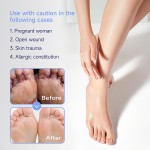 Foot Care Ointment Factory - Herbal Itchy Pruritus Dermatitis Urticaria Care