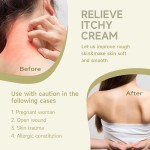 Itchy Skin Ointment Supplier - Fast Relief Moisturizing Chinese Plaster Care