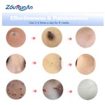 Oral Care Spray Supplier - 20g Safe Ingredients Gentle Discomfort Relief Spray