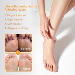 Foot Cream Supplier - ZouRunAn Herbal Beriberi Moisturizing Discomfort Cream