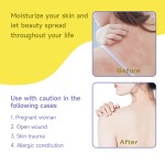 Sulfur Ointment Supplier - Herbal Eczema Psoriasis Peeling Skin Care