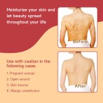 Herbal Ointment Factory - OEM/ODM Psoriasis Cleansing Itchy Skin Relief